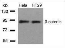 抗-CTNNB1 (Ab-33) 兔抗 affinity isolated antibody