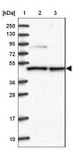 Anti-CMAS antibody produced in rabbit Prestige Antibodies&#174; Powered by Atlas Antibodies, affinity isolated antibody, buffered aqueous glycerol solution
