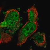 Anti-PYCRL antibody produced in rabbit Prestige Antibodies&#174; Powered by Atlas Antibodies, affinity isolated antibody, buffered aqueous glycerol solution