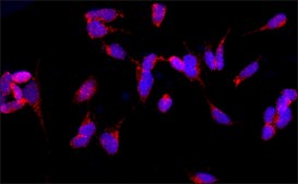 Anti-IDH1 (C-terminal) antibody produced in rabbit ~1.0 mg/mL, affinity isolated antibody