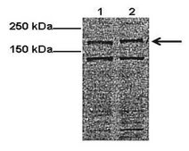 Anti-ATP7A antibody produced in rabbit affinity isolated antibody