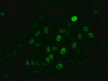 Anti-phospho-MYC (S62) antibody, clone 2A10, Rabbit Monoclonal recombinant, expressed in HEK293F cells