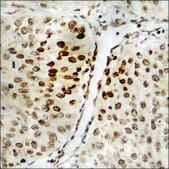 Anti-phospho-RAD51 (pTyr315) antibody produced in rabbit affinity isolated antibody