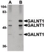 Anti-GALNT10 antibody produced in rabbit affinity isolated antibody