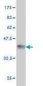 Monoclonal Anti-BAAT antibody produced in mouse clone 5B6, purified immunoglobulin, buffered aqueous solution