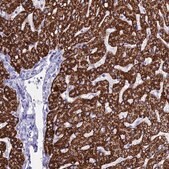 Anti-ANKRD29 antibody produced in rabbit Prestige Antibodies&#174; Powered by Atlas Antibodies, affinity isolated antibody, buffered aqueous glycerol solution