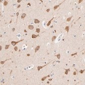 Anti-HS3ST1 antibody produced in rabbit Prestige Antibodies&#174; Powered by Atlas Antibodies, affinity isolated antibody, buffered aqueous glycerol solution