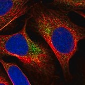 Anti-YAE1D1 antibody produced in rabbit Prestige Antibodies&#174; Powered by Atlas Antibodies, affinity isolated antibody, buffered aqueous glycerol solution
