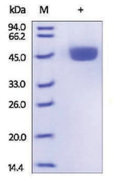 Renin from mouse recombinant, expressed in HEK 293 cells, &#8805;95% (SDS-PAGE)