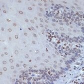 Anti-SUN2 antibody produced in rabbit