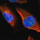 Anti-KIF1A antibody produced in rabbit Ab1, Prestige Antibodies® Powered by Atlas Antibodies, affinity isolated antibody, buffered aqueous glycerol solution