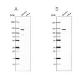 Anti-MAP6 antibody produced in rabbit Prestige Antibodies&#174; Powered by Atlas Antibodies, affinity isolated antibody, buffered aqueous glycerol solution
