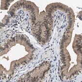 Anti-FADD antibody produced in rabbit Prestige Antibodies&#174; Powered by Atlas Antibodies, affinity isolated antibody, buffered aqueous glycerol solution