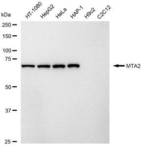 KD-Validated Anti Metastasis Associated 1 Family Member 2 Antibody, clone 24GB400, Rabbit Monoclonal clone 24GB400, recombinant rabbit monoclonal, expressed in HEK293 cells