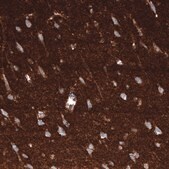 Monoclonal Anti-GAP43 antibody produced in mouse Prestige Antibodies® Powered by Atlas Antibodies, clone CL10847, purified antibody (Protein A)