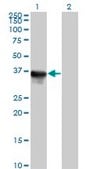 Anti-SULT1E1 antibody produced in mouse IgG fraction of antiserum, buffered aqueous solution