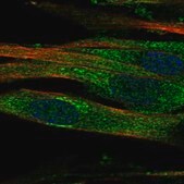 Anti-GALNT15 antibody produced in rabbit Prestige Antibodies&#174; Powered by Atlas Antibodies, affinity isolated antibody, buffered aqueous glycerol solution