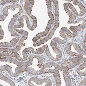Anti-CRELD1 antibody produced in rabbit Prestige Antibodies&#174; Powered by Atlas Antibodies, affinity isolated antibody, buffered aqueous glycerol solution