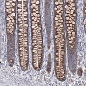 Anti-OSBPL5 antibody produced in rabbit Prestige Antibodies&#174; Powered by Atlas Antibodies, affinity isolated antibody, buffered aqueous glycerol solution