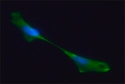 Anti-Neurofilament 160 antibody, Mouse monoclonal clone NN18, purified from hybridoma cell culture