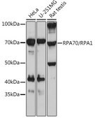 Anti-RPA70/RPA1 Antibody, clone 5R7S3, Rabbit Monoclonal
