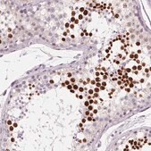 Anti-HSF5 antibody produced in rabbit Prestige Antibodies&#174; Powered by Atlas Antibodies, affinity isolated antibody, buffered aqueous glycerol solution