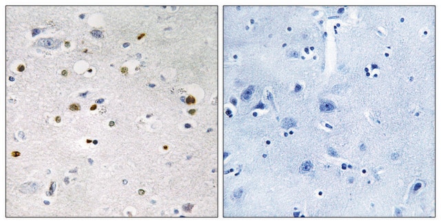 Anti-ZNF7, N-Terminal antibody produced in rabbit affinity isolated antibody
