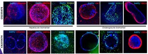 3dGRO® Human Liver Organoids (ID CS235474) Normal, Liver, Age: 57, Female, Mutation: None