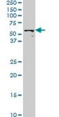 Monoclonal Anti-STK33 antibody produced in mouse clone 4F7, purified immunoglobulin, buffered aqueous solution
