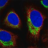 Anti-DFNB59 antibody produced in rabbit Prestige Antibodies® Powered by Atlas Antibodies, affinity isolated antibody, buffered aqueous glycerol solution