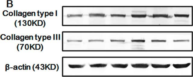 Monoclonal Anti-Collagen, Type I antibody produced in mouse clone COL-1, ascites fluid