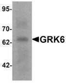 Anti-GRK6 antibody produced in rabbit affinity isolated antibody