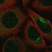 Anti-PKN2 antibody produced in rabbit Prestige Antibodies&#174; Powered by Atlas Antibodies, affinity isolated antibody