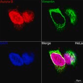 Anti-Aurora B Antibody, clone 3C4V8, Rabbit Monoclonal