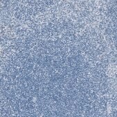 Monoclonal Anti-KRT20 antibody produced in mouse Prestige Antibodies&#174; Powered by Atlas Antibodies, clone CL9390, purified immunoglobulin, buffered aqueous glycerol solution