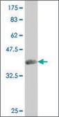 ANTI-SMAD4 antibody produced in mouse clone 4D12, purified immunoglobulin, buffered aqueous solution