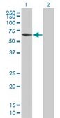 Anti-FLJ20581 antibody produced in mouse IgG fraction of antiserum, buffered aqueous solution