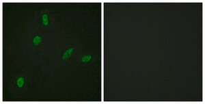 Anti-ETS1 antibody produced in rabbit affinity isolated antibody