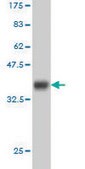 ANTI-HTRA2 antibody produced in mouse clone 6H8, purified immunoglobulin, buffered aqueous solution