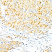 Anti-BAX antibody produced in rabbit