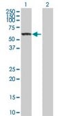 Anti-CES1 antibody produced in rabbit purified immunoglobulin, buffered aqueous solution