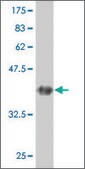 ANTI-GUCY2C antibody produced in mouse clone 1D11, purified immunoglobulin, buffered aqueous solution
