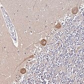 Anti-NARS antibody produced in rabbit Prestige Antibodies&#174; Powered by Atlas Antibodies, affinity isolated antibody, buffered aqueous glycerol solution