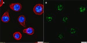 Anti-HHV-8 LNA-1 Antibody, clone 5L10 ZooMAb® Rabbit Monoclonal recombinant, expressed in HEK 293 cells
