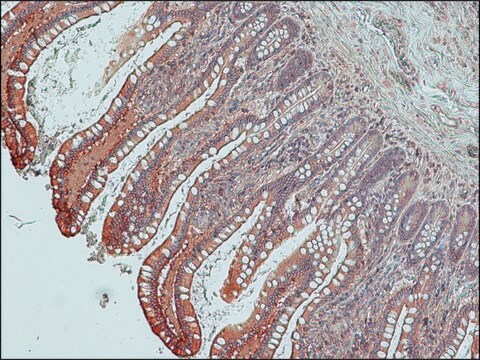 Anti-Villin-1 (internal) antibody produced in rabbit ~1.0&#160;mg/mL, affinity isolated antibody