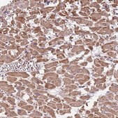 Anti-TMEM126A antibody produced in rabbit Prestige Antibodies&#174; Powered by Atlas Antibodies, affinity isolated antibody, buffered aqueous glycerol solution