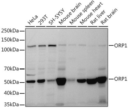Anti-ORP1 Antibody, clone 9U7Y3, Rabbit Monoclonal
