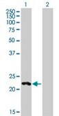 Anti-HECTD2 antibody produced in mouse IgG fraction of antiserum, buffered aqueous solution