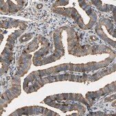 Anti-TLN1 antibody produced in rabbit Prestige Antibodies&#174; Powered by Atlas Antibodies, affinity isolated antibody, buffered aqueous glycerol solution