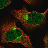 Anti-ZNF619 antibody produced in rabbit Prestige Antibodies® Powered by Atlas Antibodies, affinity isolated antibody, buffered aqueous glycerol solution